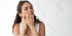 Galderma & AKLIEF Cream -Me Being Me Campaign and the Acne Burden