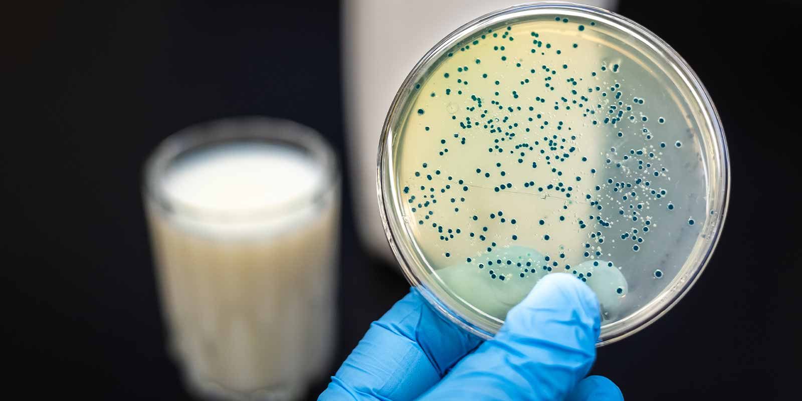 How Human Milk Oligosaccharides (HMOs) Can Help Your Gut