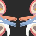 KRYSTEXXA-Real-World-Use-in-Dialysis-Patients