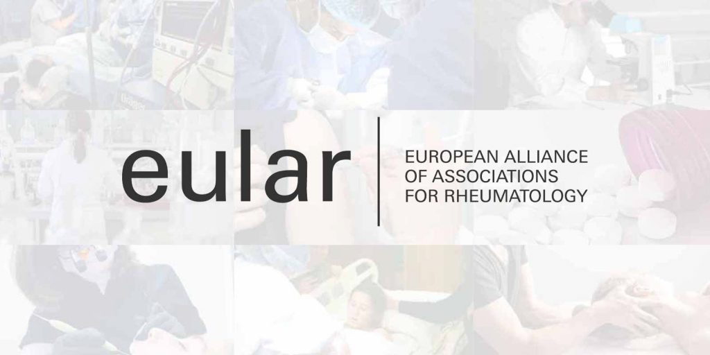 AstraZeneca EULAR Data Supports Next-Wave of Lupus Treatment