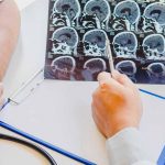 Getting Back To The Doctor For Multiple Sclerosis Patients