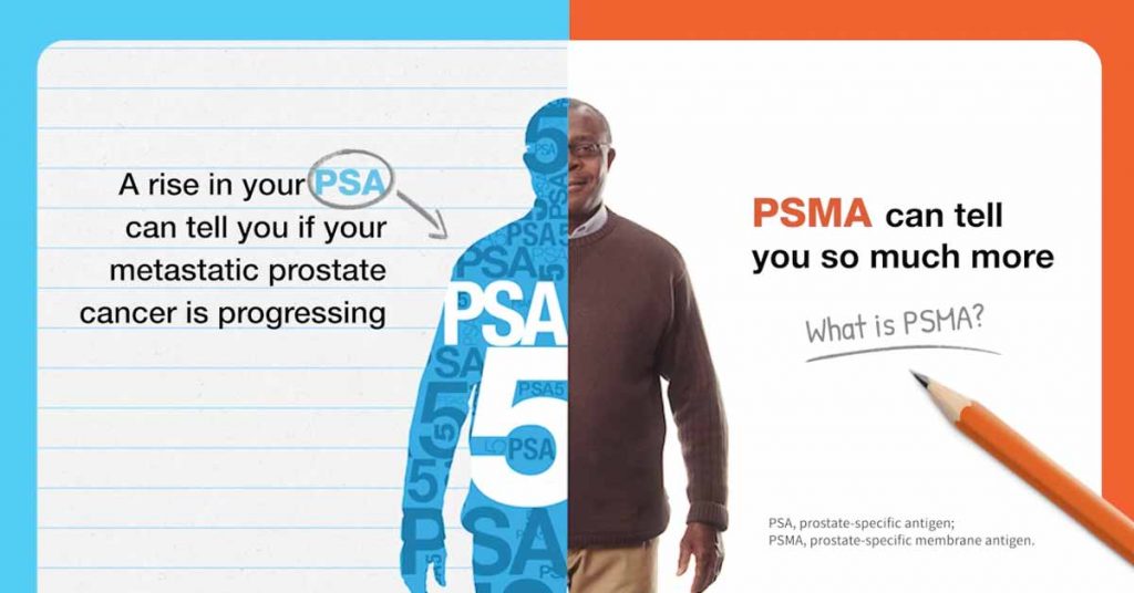 New Methods in Prostate Cancer Detection