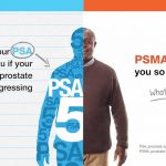 New Methods in Prostate Cancer Detection