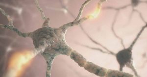 AES 2021 - UCB's New Data Across Epilepsy Portfolio