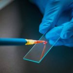 CareDX - Allosure Lung for Transplant Surveillance