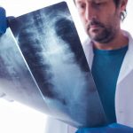 Distal Femur Replacements and Spinal Anesthesia In ​Same Day Discharge Patients