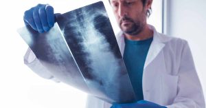 Distal Femur Replacements and Spinal Anesthesia In ​Same Day Discharge Patients