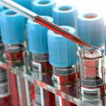 Innovative First-Of-Its-Kind Blood Test Can Help Turn the Tide Against Liver Disease