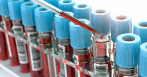 Innovative First-Of-Its-Kind Blood Test Can Help Turn the Tide Against Liver Disease