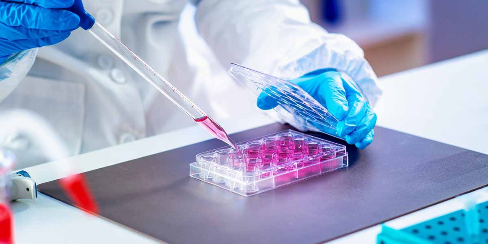 Cytovia Therapeutics – Natural Killer Cells to Fight Cancer