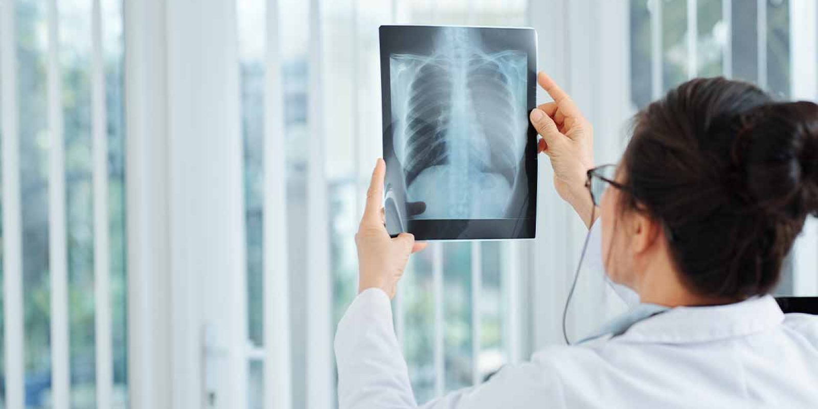 Current Global Lung Cancer Screening Landscape