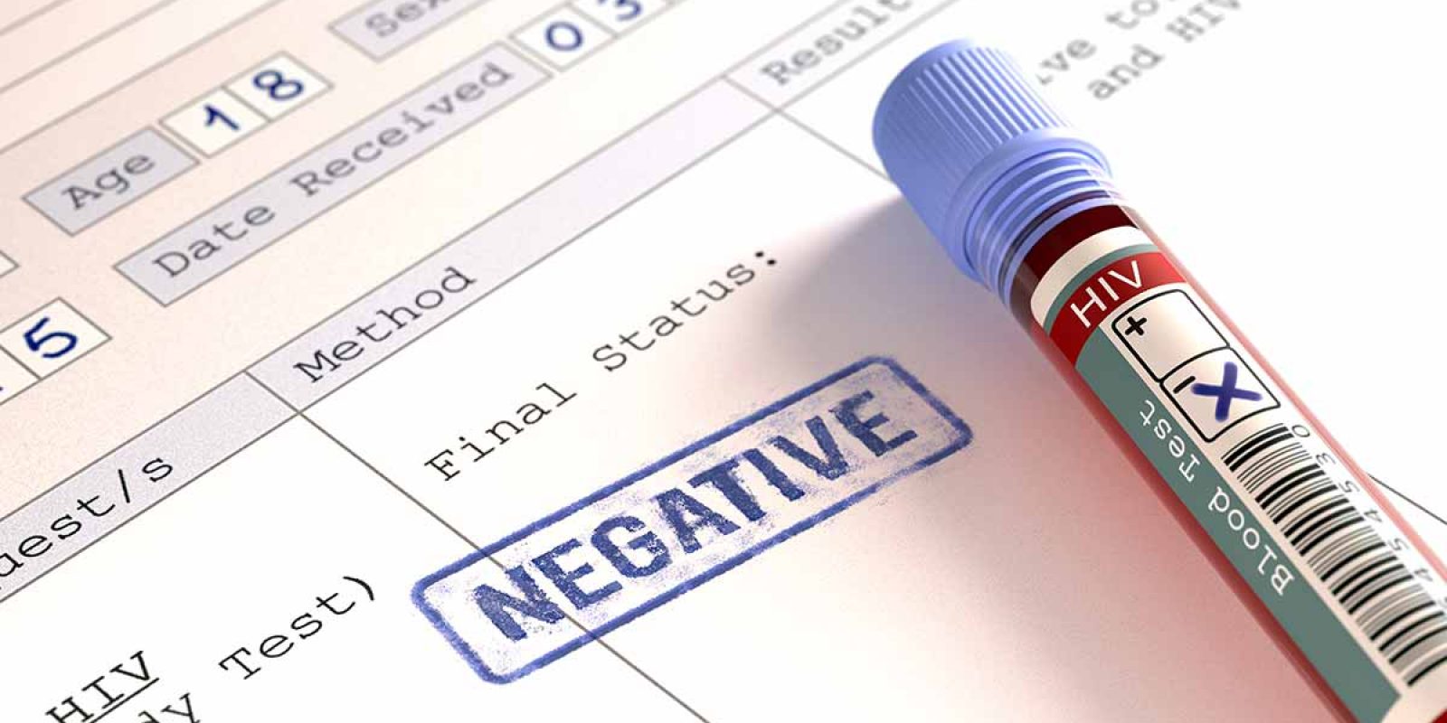 HIV Testing Plummeted During Pandemic