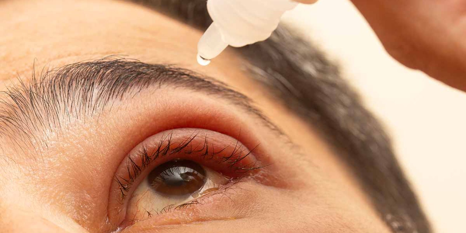 Innovation1 Biotech –  Cannabinoid Type 2 and  Children’s Eye Health
