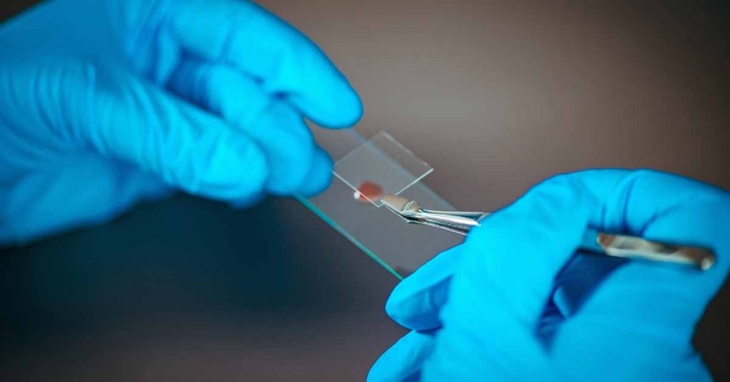 BioStem Technologies - Innovating in Tissue Regeneration