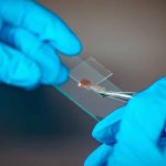 BioStem Technologies - Innovating in Tissue Regeneration