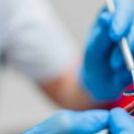 Risk of Toxic Mercury Poisoning Due to Dental Fillings