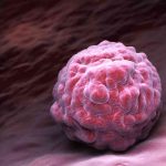 How Some Bone Marrow/Stem Cell Transplants Can Lead to Complications