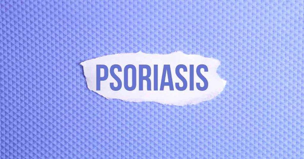 How Warmer Weather Affects Psoriasis & Tips to Help Those Impacted