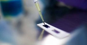 Beljanski Foundation's Latest Research Project on Breast Cancer Stem Cells