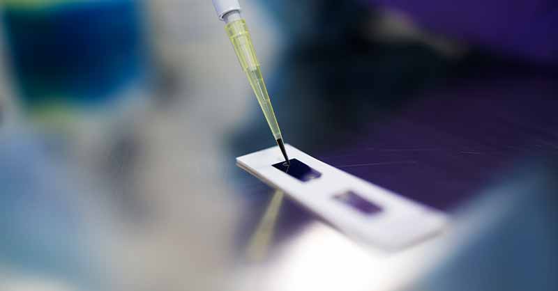 Beljanski Foundation's Latest Research Project on Breast Cancer Stem Cells