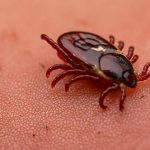 Tick Bites: Symptoms, Prevention, and Treatment