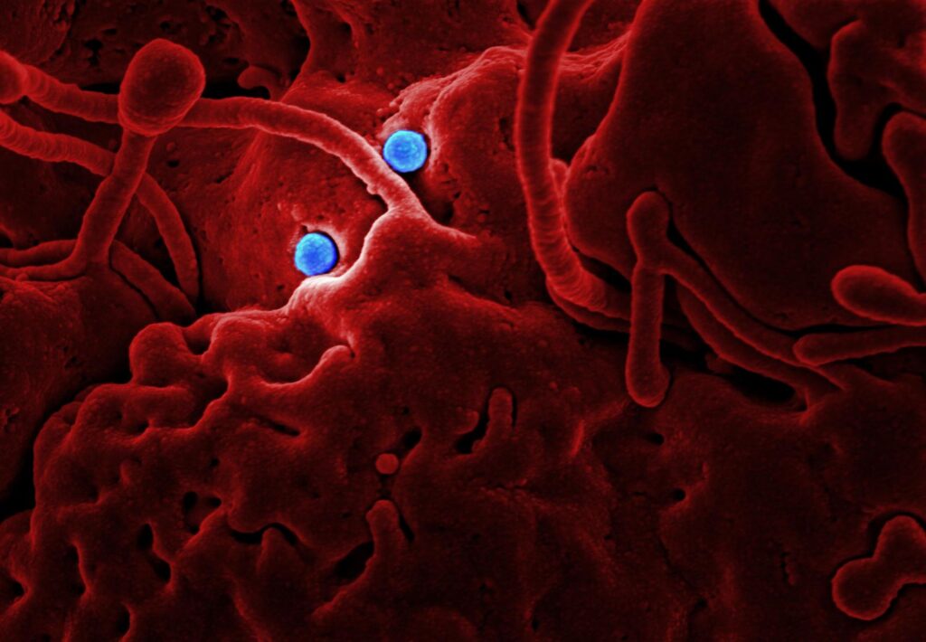 Microscopic image of coronavirus particles
