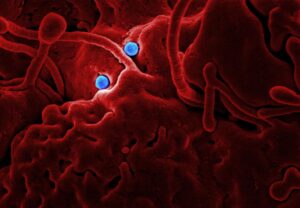 Ebola virus particles under microscope