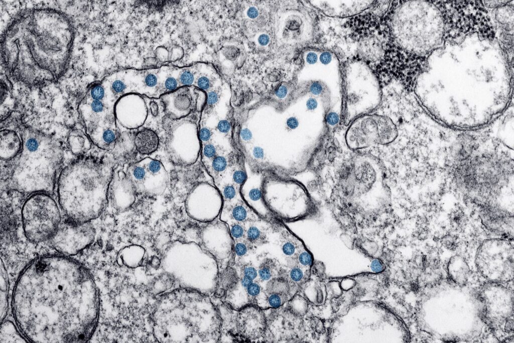 Electron microscope image of Ebola virus particles