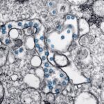 Electron microscope image of Ebola virus particles