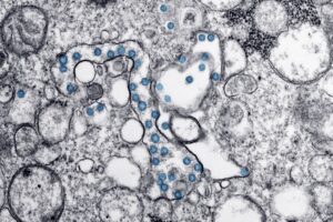 Electron microscope image of Ebola virus particles